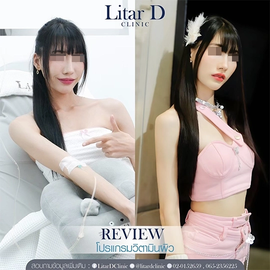 ดริปวิตามิน 2