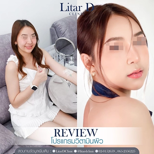 ดริปวิตามิน 3