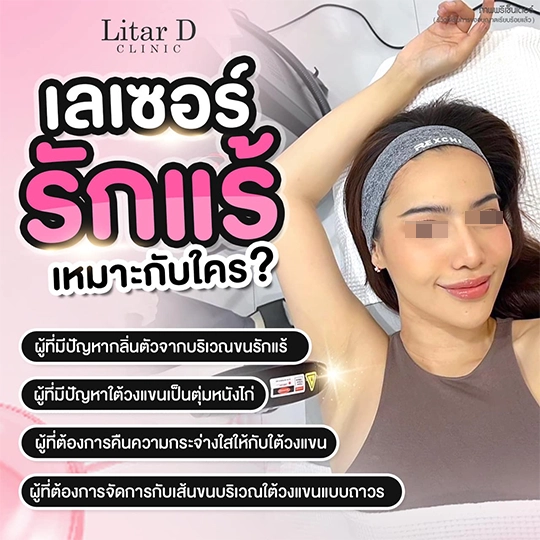 เลเซอร์ขน 1